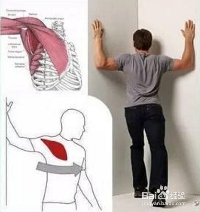 如何判断自己是不是圆肩驼背