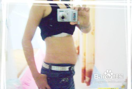 纹丝不长之妊娠纹歼灭战