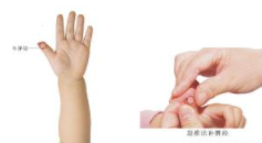 鹅口疮的推拿调理手法,适合婴幼儿