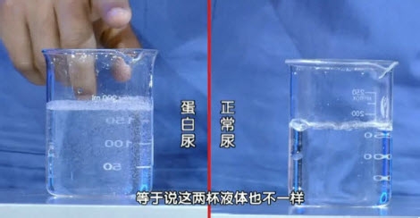 看尿液测隐患