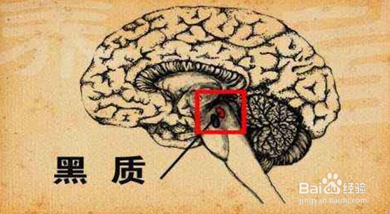 帕金森如何诊断