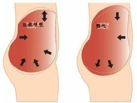 提肛運動怎麼做 常見5大提肛方法