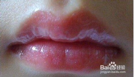 女生如何保养好嘴唇