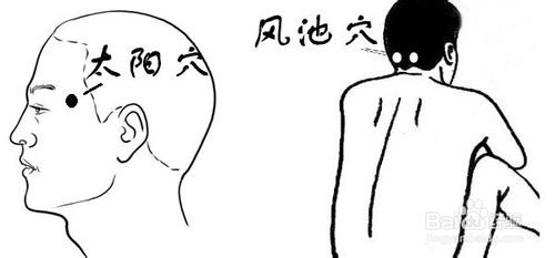 坐飞机晕机应该如何应对