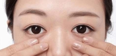 几种去眼袋的好方法.