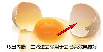 怎样去除黑头更有效