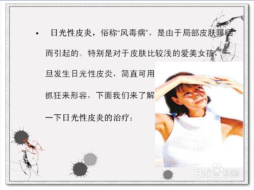 日光性皮炎的治疗