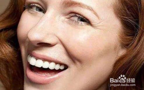 怎么样去除眼角皱纹