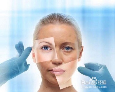 暗黄皮肤如何美白 自然兰助你变身白富美