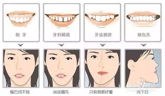 整牙有没有必要？