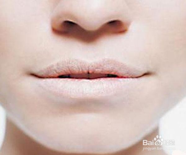 肝不好，脸上多半有4种现象