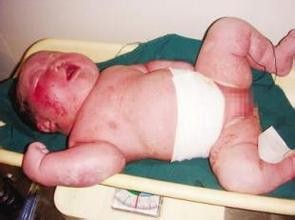 宝宝撞伤后必须立刻就医的情况