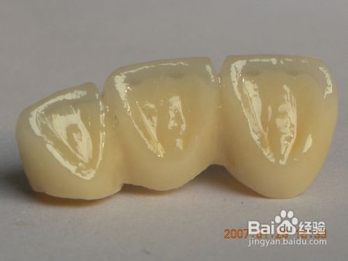 全瓷牙的效果好不好