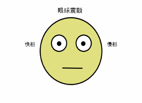 眼球震颤如何诊断,其实你自己也可以确诊