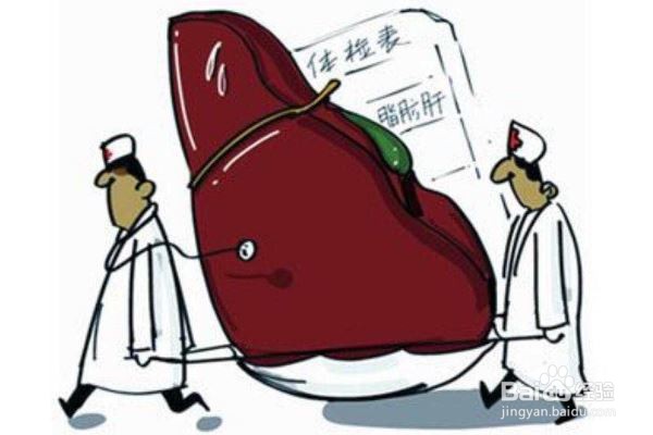 有哪些原因会引起脂肪肝