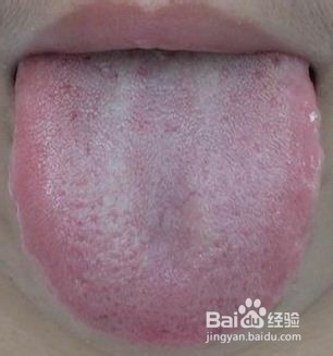 怎样判断体内是否有湿气