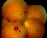 小孩子咳嗽的应对方法