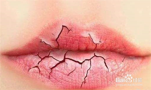 涂抹口红如何避免唇部起皮
