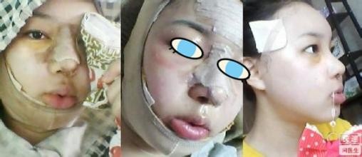怎么样简单的消灭讨厌的各种痘痘，一星期见效。