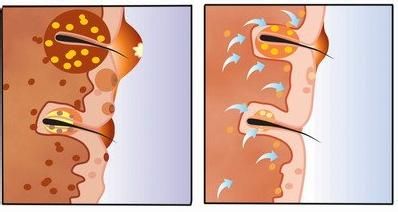 小心!吃糖太多你会提前衰老