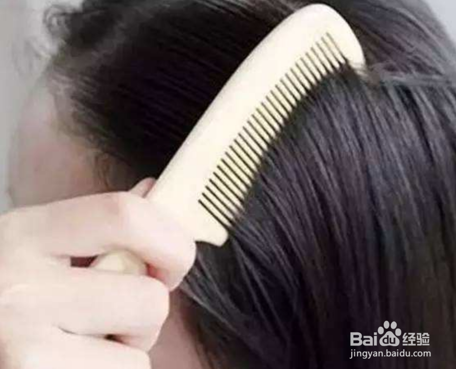 头皮出油多怎么办