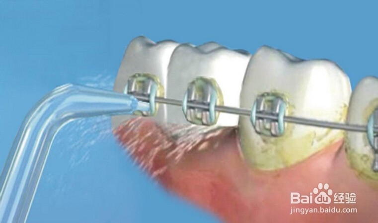 洗牙应该怎么洗才好