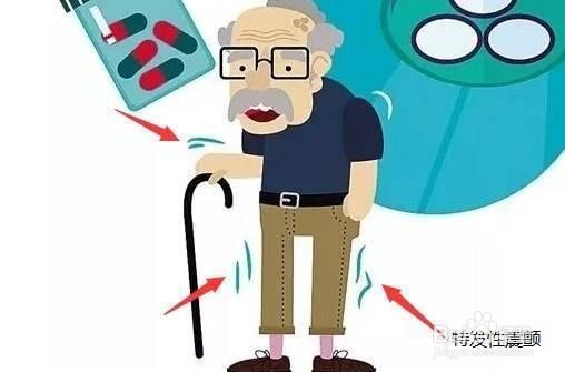 特发性震颤不治疗会严重吗