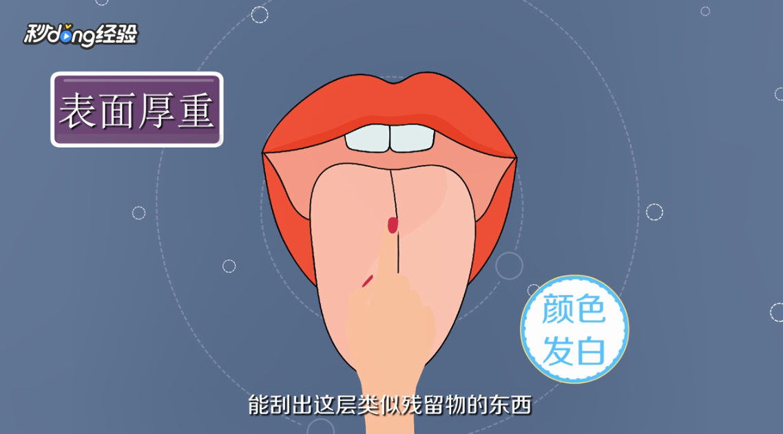 舌苔颜色各代表什么意思