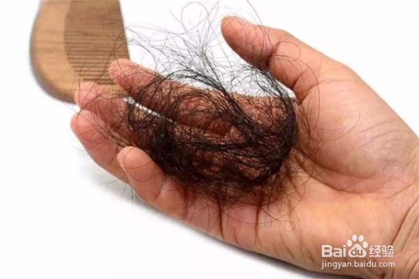 总是掉头发有哪些拯救的方法