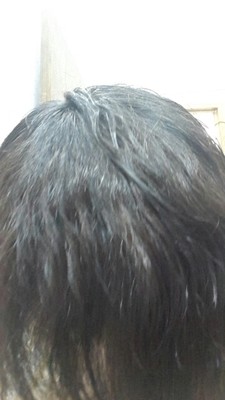 头发软化后太贴怎么办