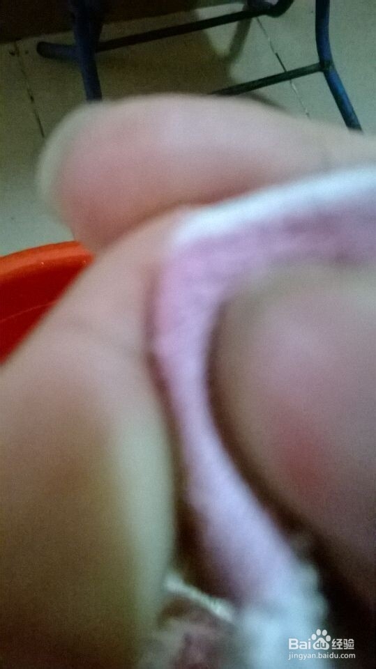 治疗感冒，不用花一分钱