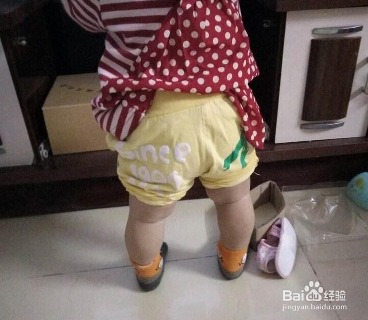 怎样预防宝宝的O型腿