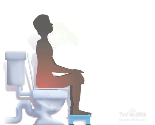 得了便秘怎么办