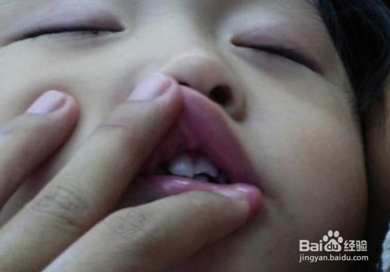 牙松动疼痛怎么办