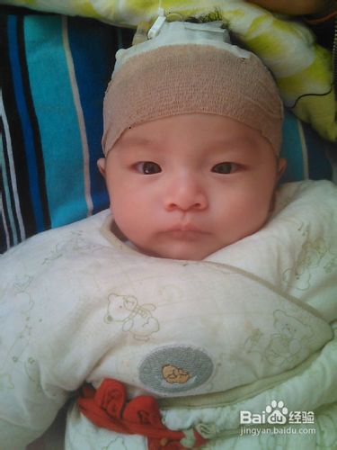 怎样知道宝宝听力有障碍？