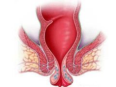 肛门脱出是怎么回事 百度经验