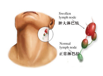 如何巧记快速记英语单词（联想记忆）：[6]