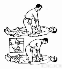 人工呼吸注意哪些问题?