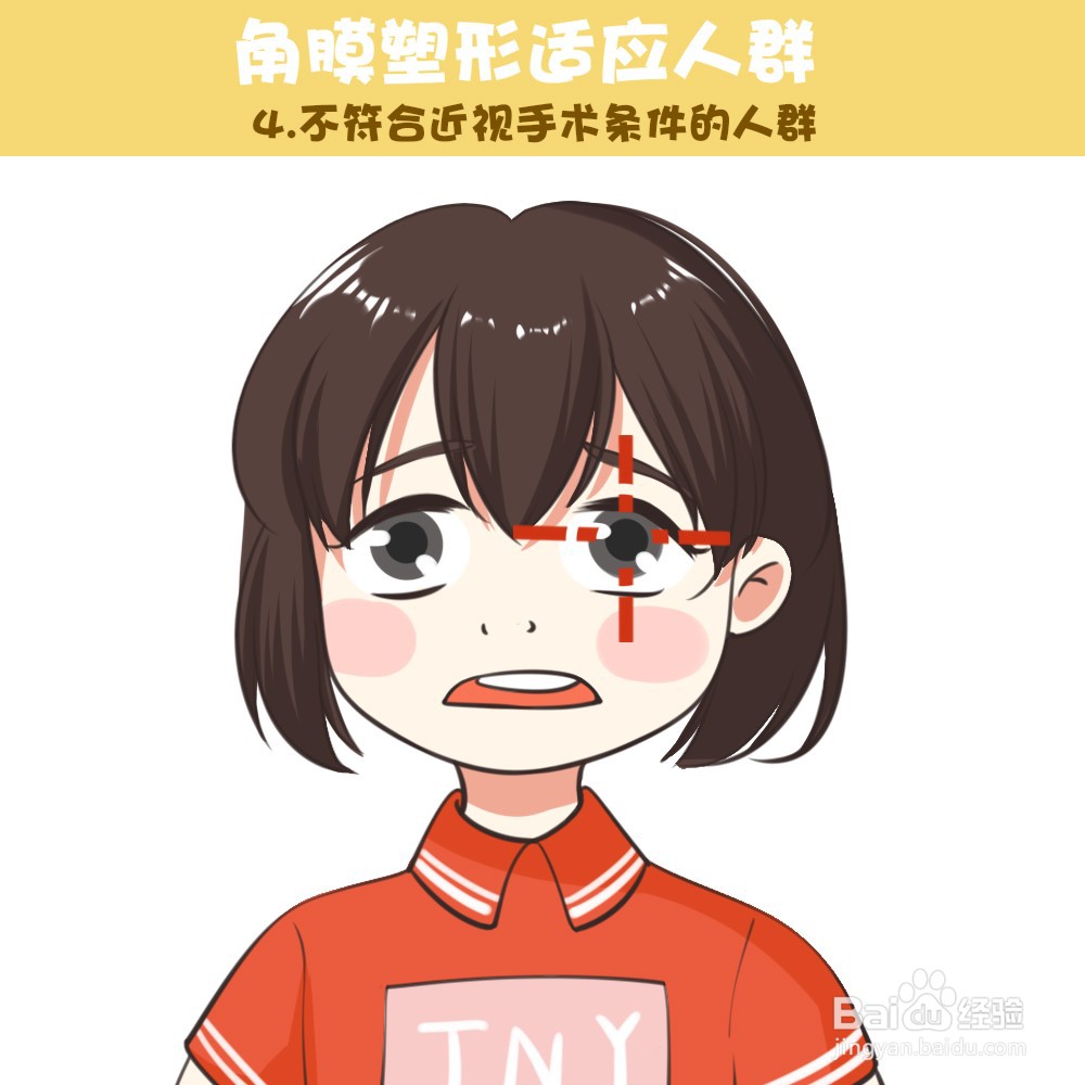 角膜塑形镜适应人群