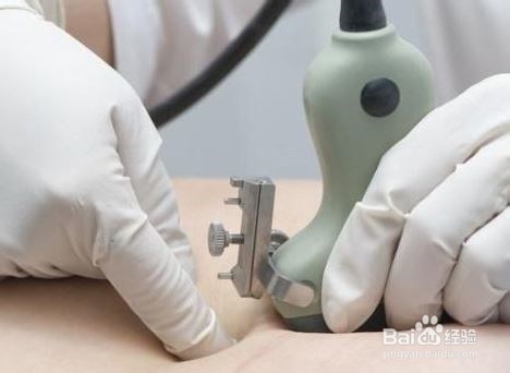 结扎对女人的身体有什么影响呢？