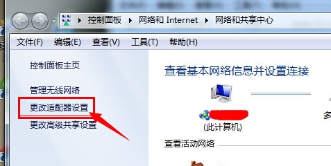 怎么禁用无线网络