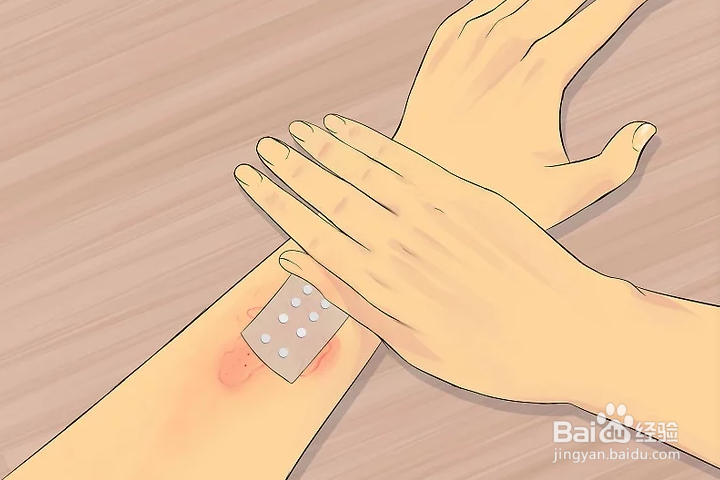 如何治疗皮肤过敏现象