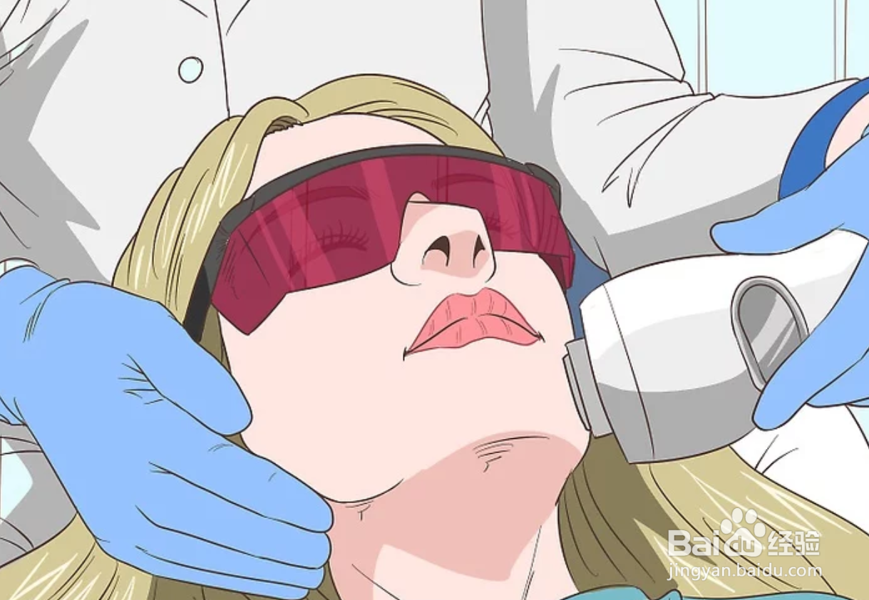 如何去除女性脸上的毛发