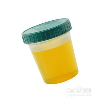 参加单位体检注意事项