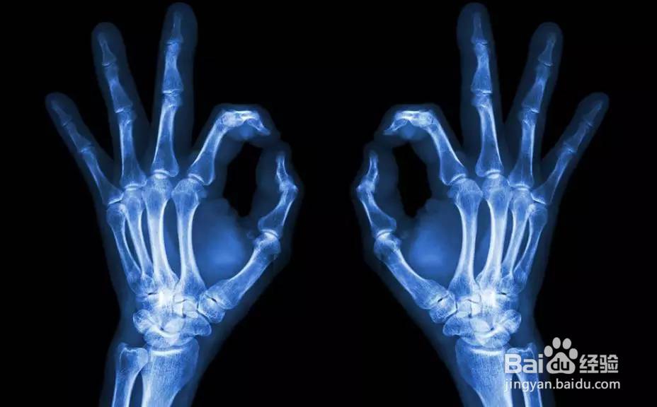 如何识别B超、X线、CT、核磁的共振的不同用途