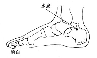 百病拔罐：[53]崩漏的拔罐疗法