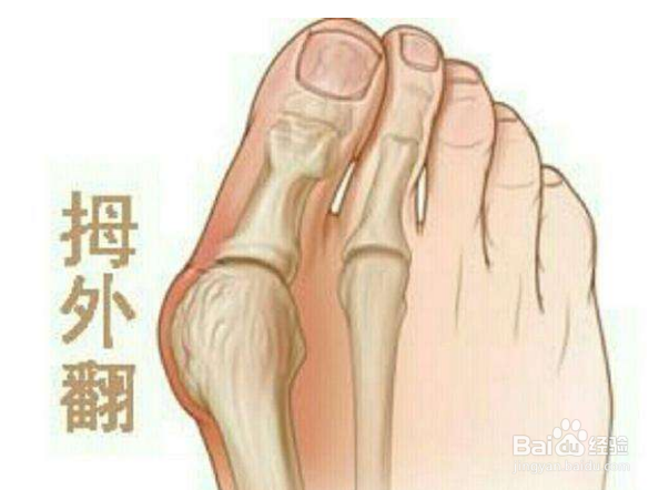 穿高跟鞋要注意什么？对身体有什么危害？