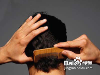 老掉头发怎么办
