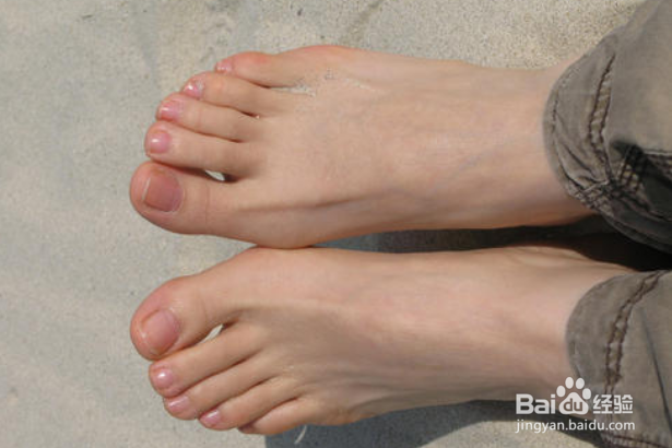 脚臭是怎么回事?教你4个方法解决它
