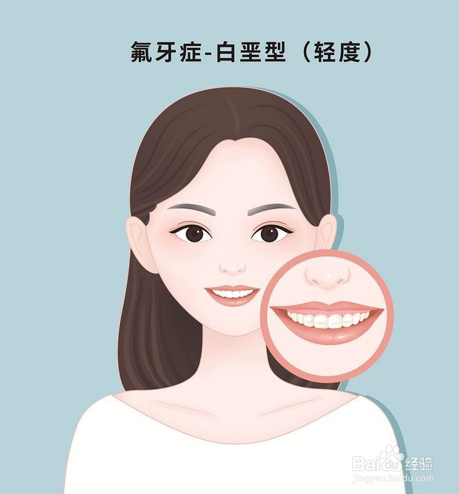 如何治疗氟牙症